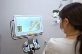 口腔内スキャナーの画面に映った歯並びのデータ